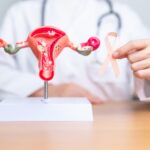 Doctor holding Peach ribbon with Uterus and Ovaries model for September Uterine Cancer Awareness